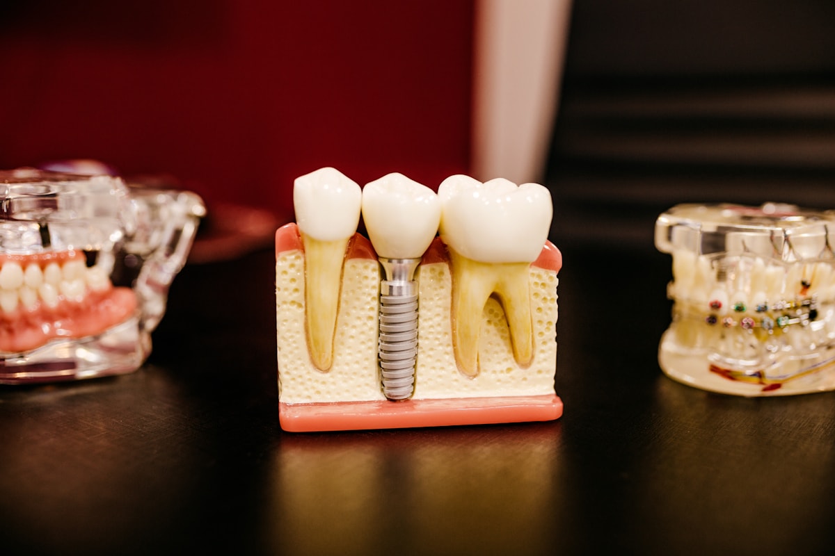 Modelo dental clínico con implante unitario