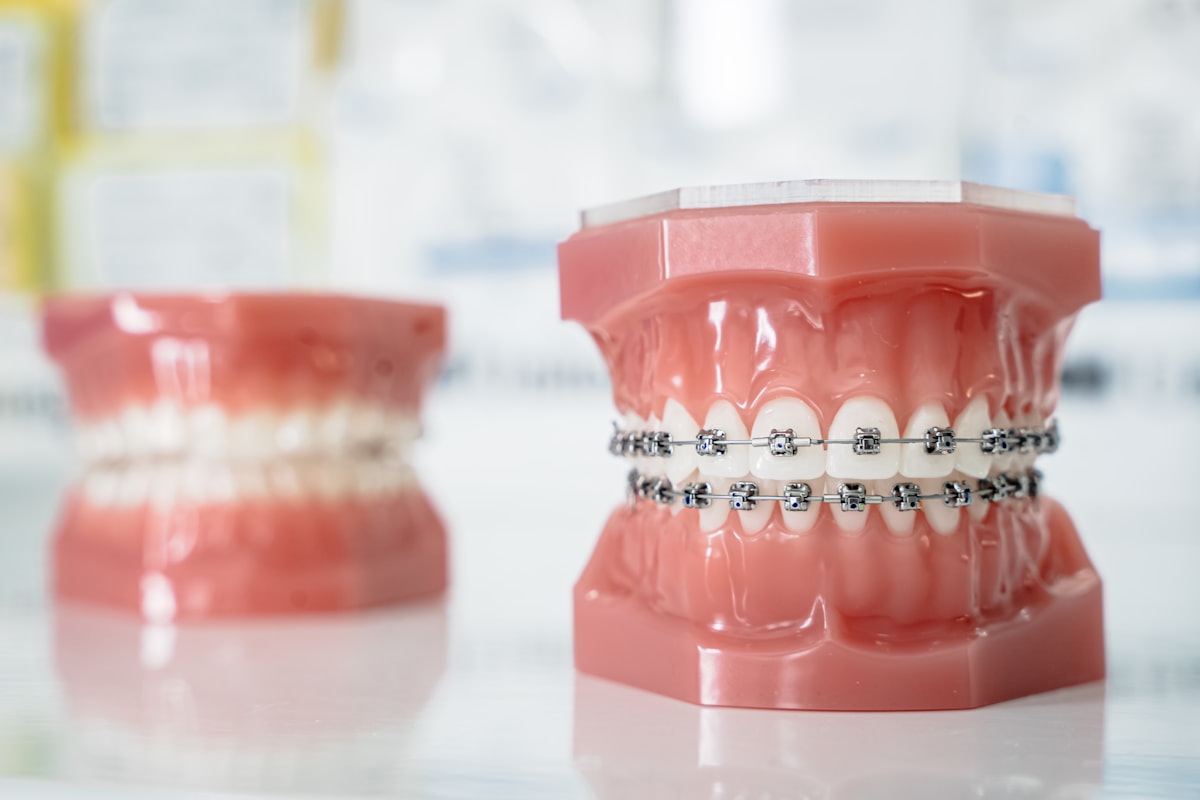 Modelo odontológico con brackets metálicos